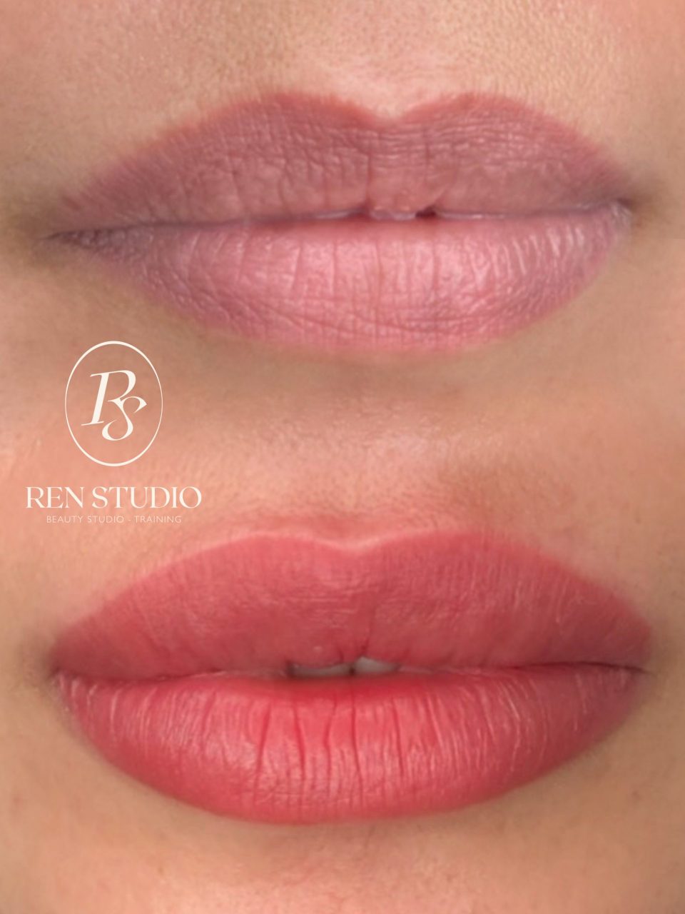 Neutralization Lips